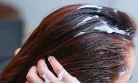 موس مو چیست؟