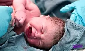 زایمانهای میلیونی