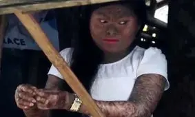 دختری معروف به بانوی مار + عکس