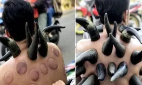 استفاده از شاخ بوفالو برای شفای بیماران