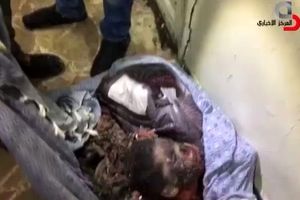فیلم/ باقیمانده جسد کودکی که امروز در دمشق منفجر شد(۱۸+)