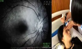 اعتیاد به موبایل دختر جوان را کور کرد!