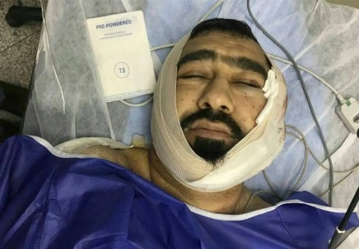 حمله خونین یکی از اوباش منطقه شرق تهران به یک طلبه +عکس