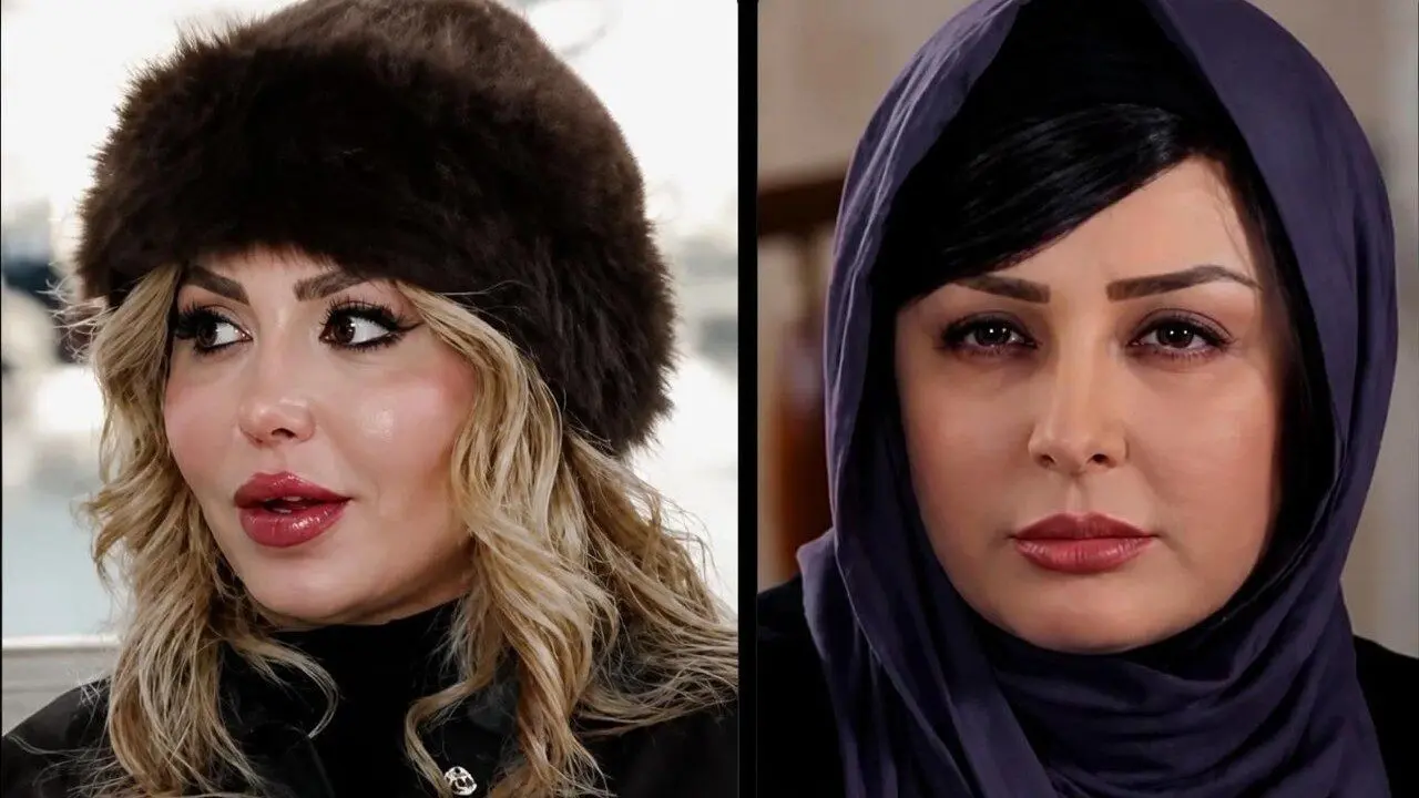 از الهام حمیدی تا نیوشا ضیغمی؛ چرا جراحی زیبایی زنان به قضاوت عمومی گره می‌خورد؟ | تصاویر