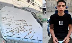 فیلم گفتگو با آخرین قربانی اسیدپاشی در تهران