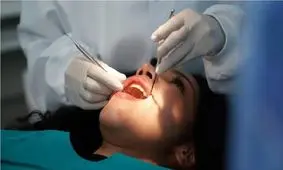 پژوهشگران ایرانی مقیم آمریکا «چاپ ۳بعدی روکش دائمی دندان ظرف چند ساعت» را محقق کردند