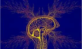 درمان صرع با کمک هوش مصنوعی