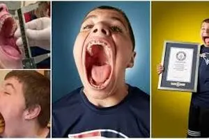 ایزاک جانسون؛ مردی با بزرگ‌ترین دهان دنیا/ ویدئو