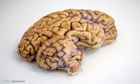 سفرفضایی چه فشارهایی به مغز انسان وارد می کند؟