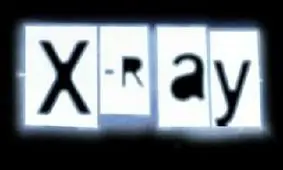 اشعه ایکس سفر هوایی بیشتر از رادیوگرافی دندان است