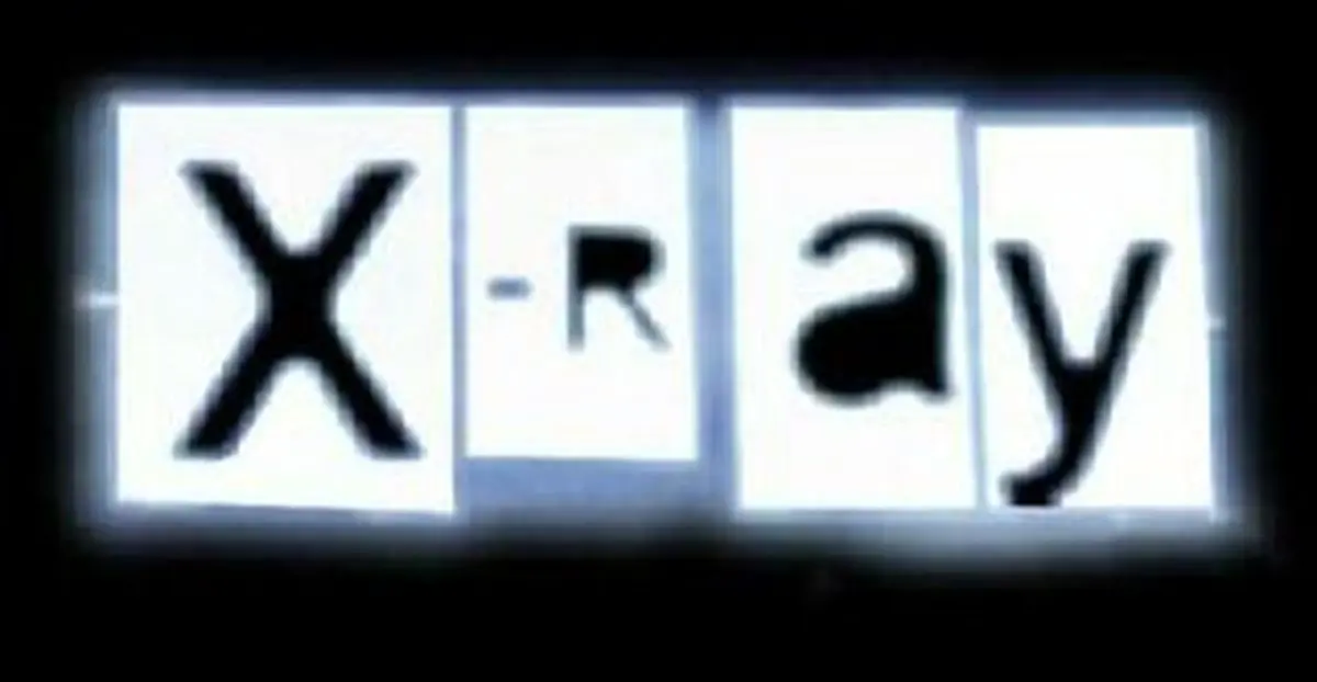 اشعه ایکس سفر هوایی بیشتر از رادیوگرافی دندان است