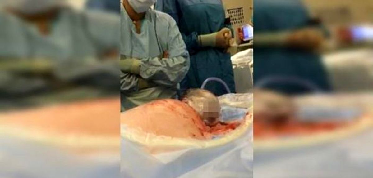 فیلم /این نوزاد خود از شکم مادر بیرون می‌آید و پزشکان دست به سینه ایستاده‌اند. این ویدئو را که تا کنون ۹ میلیون بازدید کننده داشته از دست ندهید