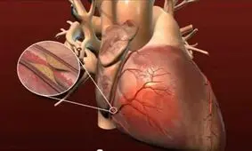 ۱۲ خوراکی که رگ‌های قلب را باز می‌کند