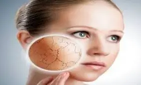 درمان قطعی خشکی پوست در پاییز