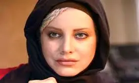 پیشنهاد عجیب به بازیگر زن در اینستاگرام / وقتی عمل زیبایی دردسرساز می‌شود