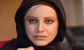 پیشنهاد عجیب به بازیگر زن در اینستاگرام / وقتی عمل زیبایی دردسرساز می‌شود