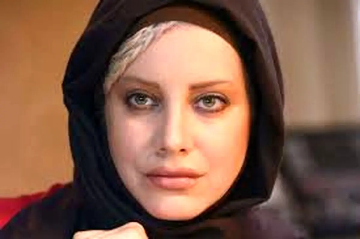 پیشنهاد عجیب به بازیگر زن در اینستاگرام / وقتی عمل زیبایی دردسرساز می‌شود