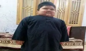 حذف 75 درصد از معده پسر خوش اشتهای هفت ساله