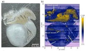 سرطان با جریان الکتریسیته مشخص می شود