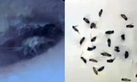 خارج کردن ۲۶ سوسک از گوش مرد چینی