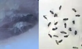 خارج کردن ۲۶ سوسک از گوش مرد چینی