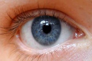یک نوع ژل برای پانسمان فوری چشم ابداع شد