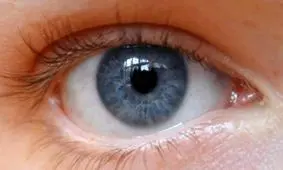 یک نوع ژل برای پانسمان فوری چشم ابداع شد