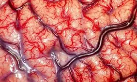 چگونه آلودگی هوا سکته قلبی را رقم می زند؟