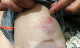 ضرب و شتم دانش آموز لرستانی توسط مدیر مدرسه؛ مدیر عزل شد