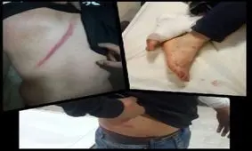 ضرب و شتم میوه‌فروشان ملایری با باتوم / چند میوه‌فروش راهی بیمارستان شدند