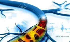 «انسداد» علت ایجاد غلظت خون، فشار خون، کبد چرب و واریس