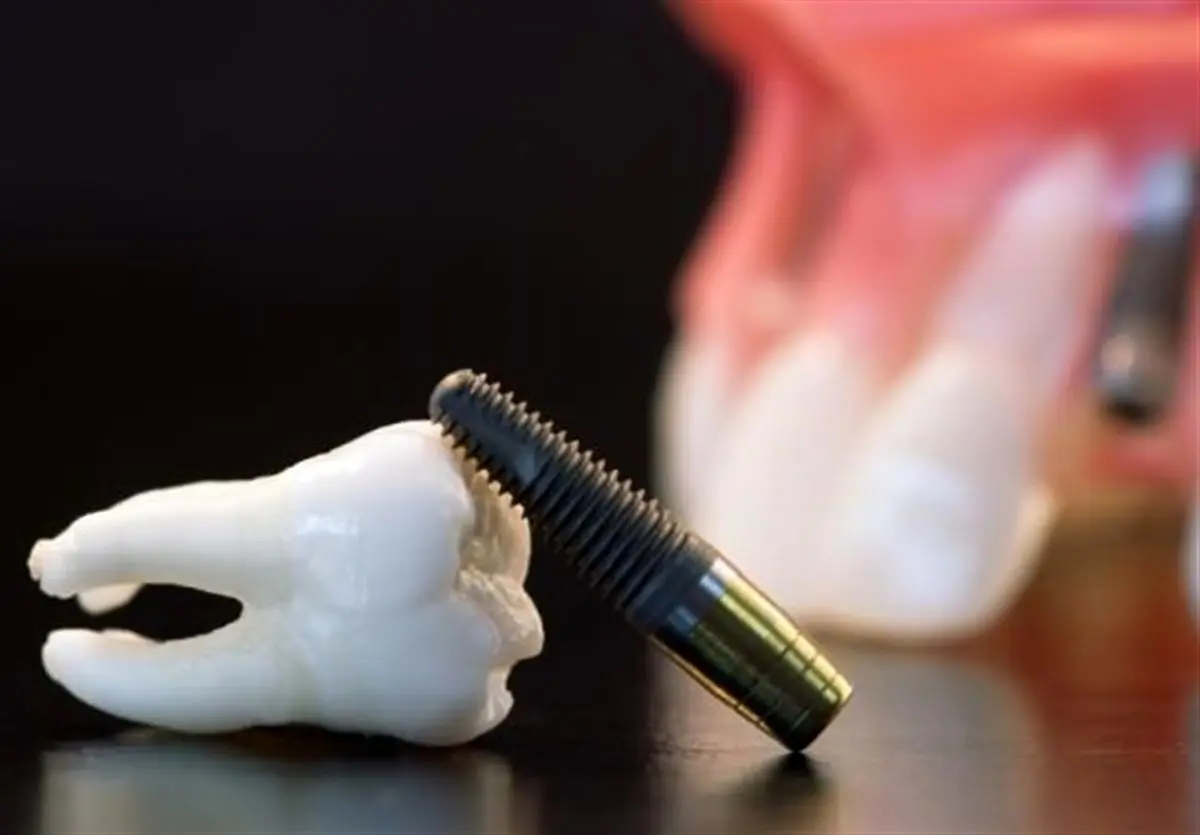 مشخصات تجهیزات پزشکی که توزیع آنها تخلف است