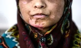 افزایش ۵۹ درصدی همسرآزاری در کهگیلویه و بویراحمد