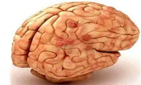 تبخال مغزی چه نشانه‌هایی دارد؟ سلامت نیوز: تبخال مغزی چه نشانه‌هایی دارد؟