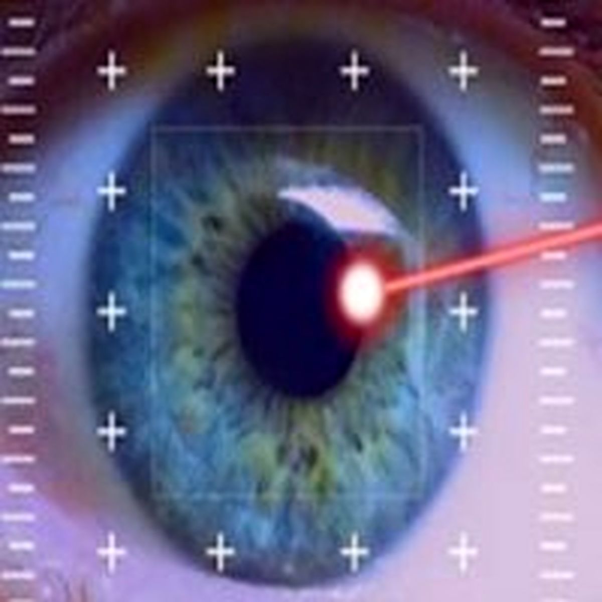 ابتلای نیمی از جامعه به نزدیک بینی طی 30 سال آینده