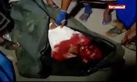 جنایت رژیم سعودی در یمن؛ ۵۲ کشته و ۱۰۰ زخمی در بمباران بیمارستان