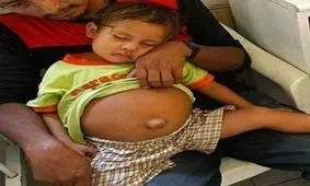 ماجرای بار دار شدن دختر معصوم 3 ساله + عکس