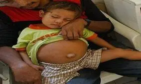 ماجرای بار دار شدن دختر معصوم 3 ساله + عکس