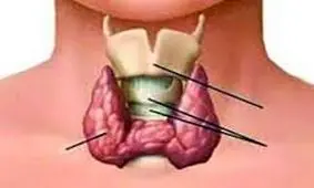 چه عواملی باعث اختلال در غده تیروئید می‌شوند؟