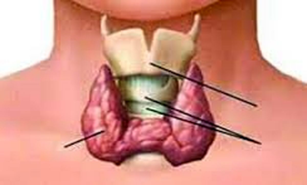 چه عواملی باعث اختلال در غده تیروئید می‌شوند؟