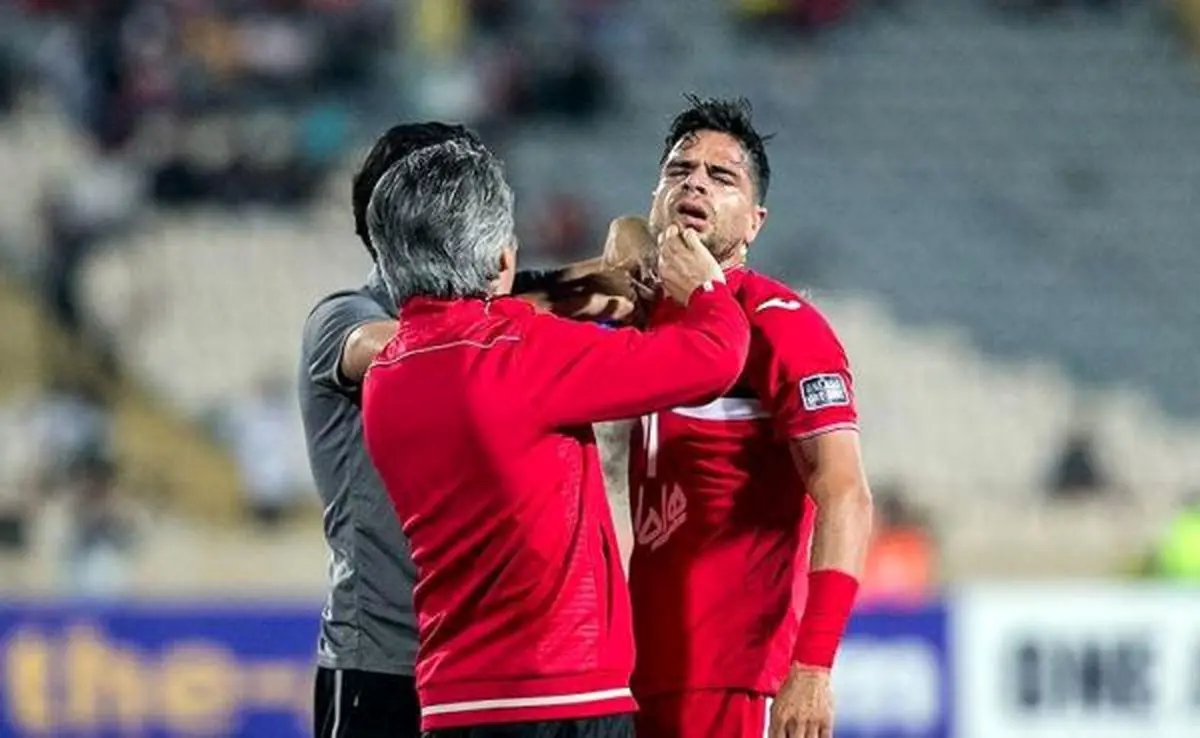 خوبیِ مصدومیتِ کمال؛ بازگشت به لوزی محبوب!