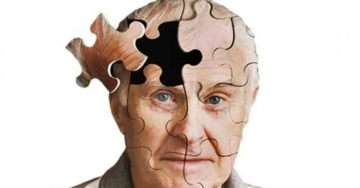 پیشگیری از آلزایمر با داروی موجود