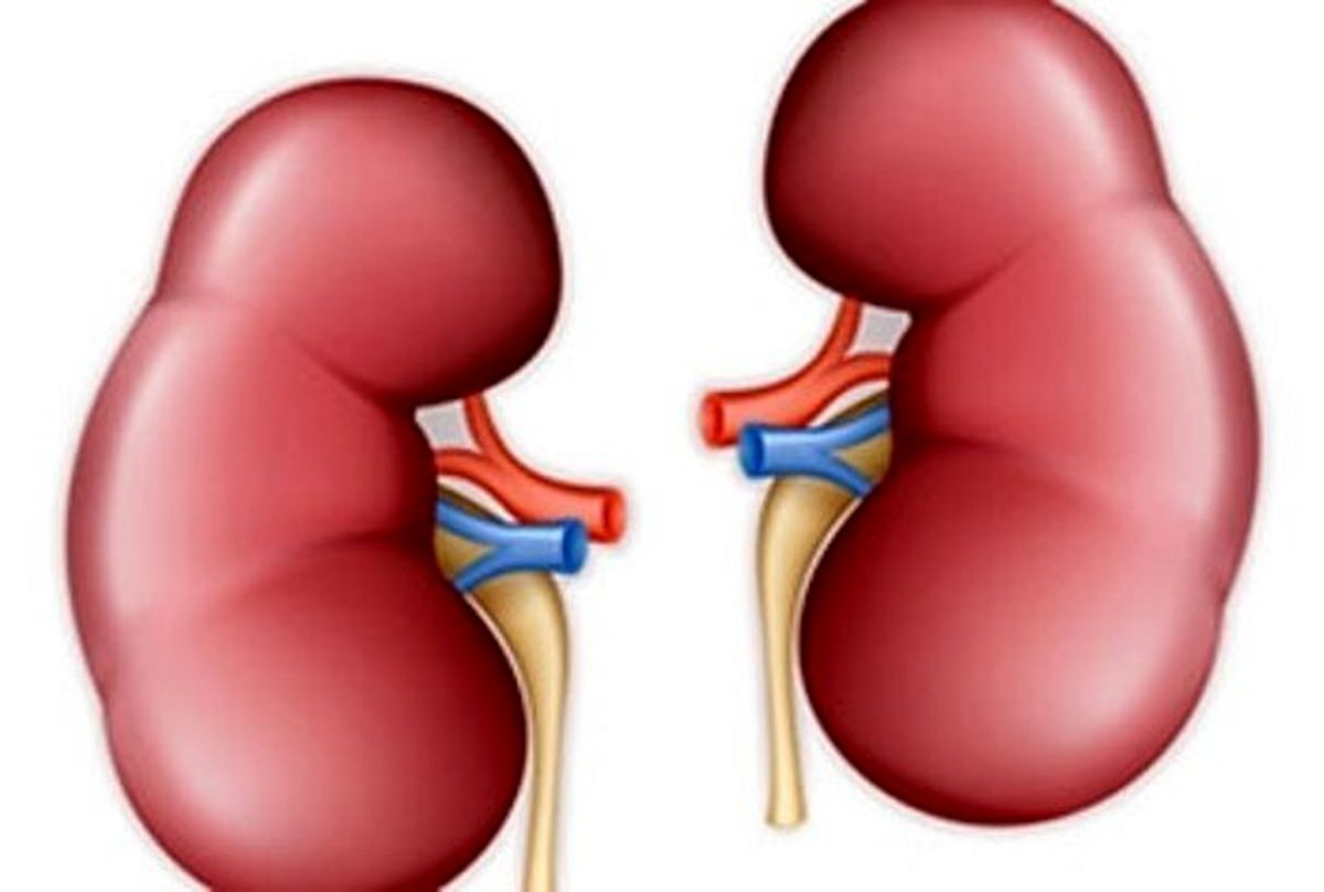 شیوع بالای بیماری سنگ کلیه در شمال و غرب کشور