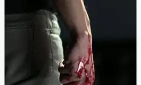 برادرکشی در آق قلا