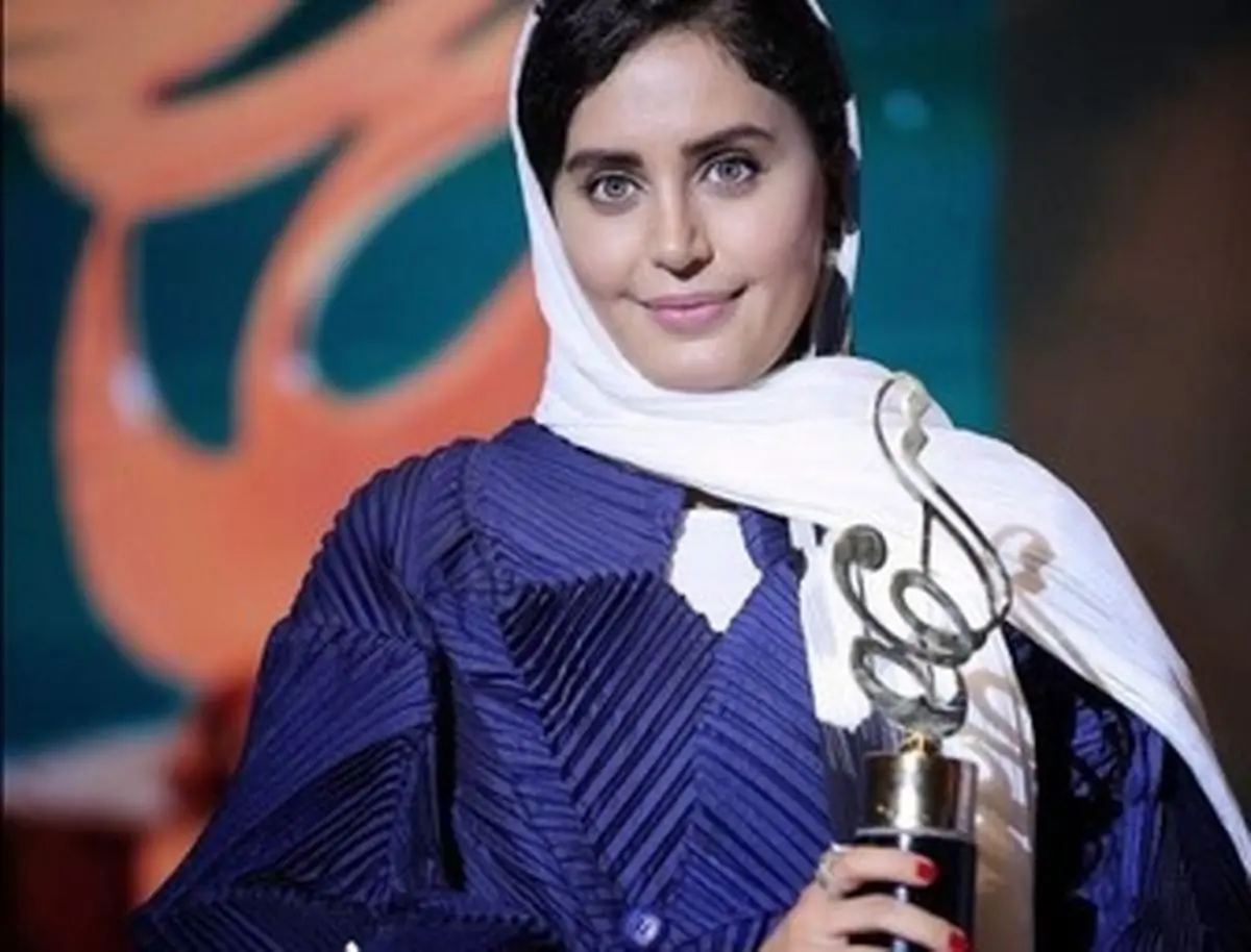 «الناز شاکردوست» هم پوست می اندازد!