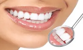 روش جرم گیری دندان در خانه
