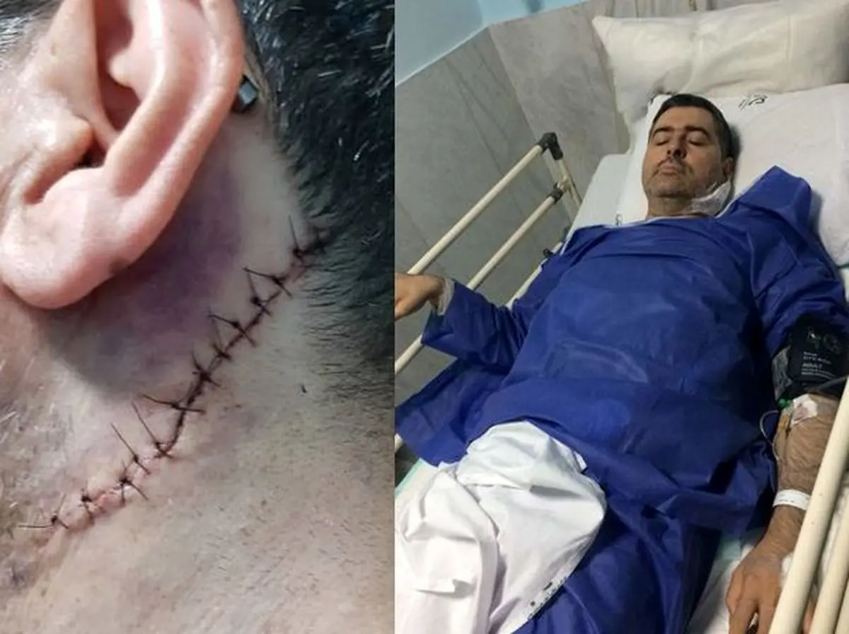 سوقصد به پزشک تهرانی/ ابتدا اسپری اشک‌آور به صورتم زد؛ سپس چاقو به گردنم