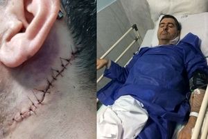 سوقصد به پزشک تهرانی/ ابتدا اسپری اشک‌آور به صورتم زد؛ سپس چاقو به گردنم