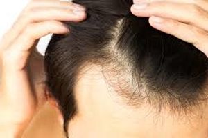 چگونه از موهای خود در برابر کَلر استخر محافظت کنیم