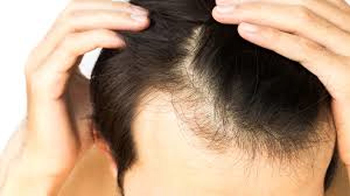چگونه از موهای خود در برابر کَلر استخر محافظت کنیم